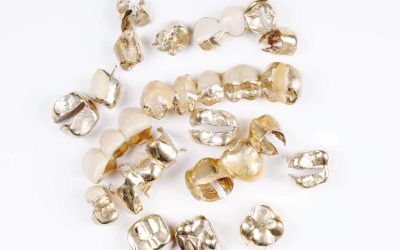 How Much Are Dental Scrap Gold and Silver Worth?