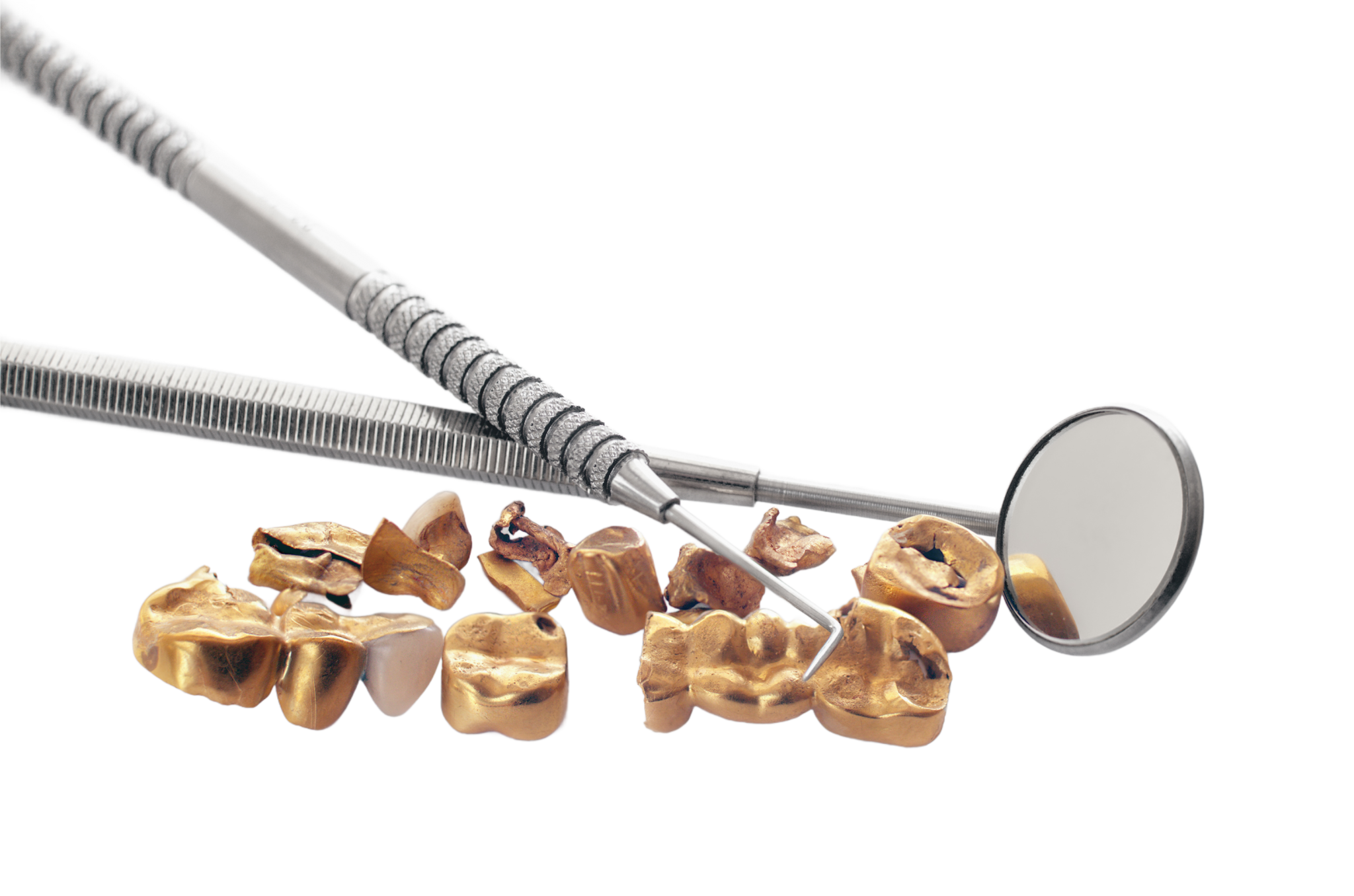 shutterstock_309275003_edited-dental-gold